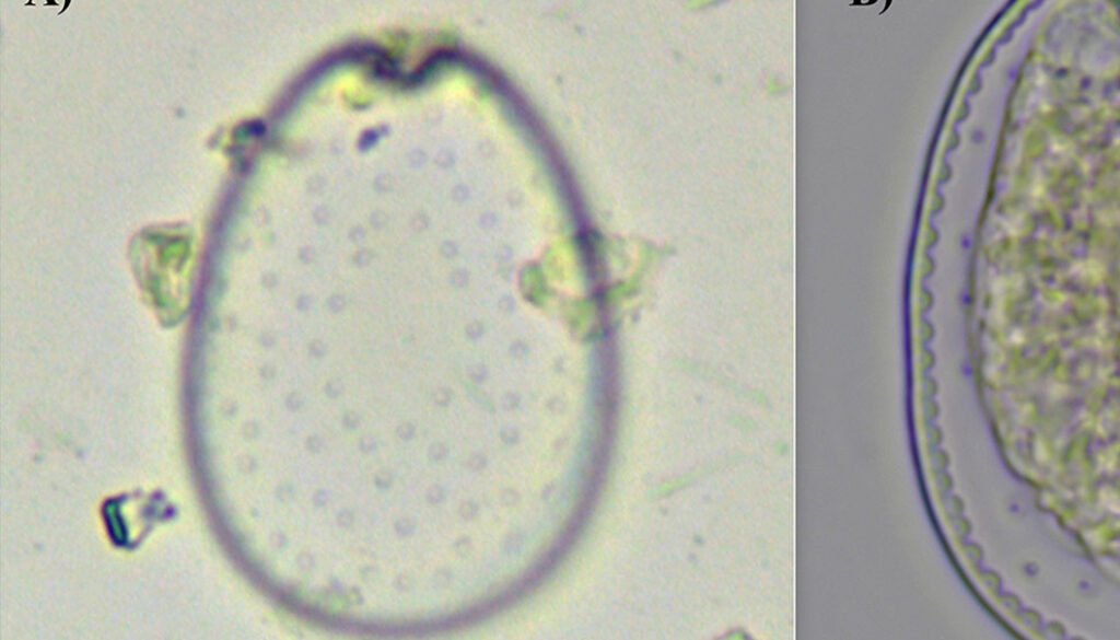 02destaca-Prorocentrum-lima-ene-2026