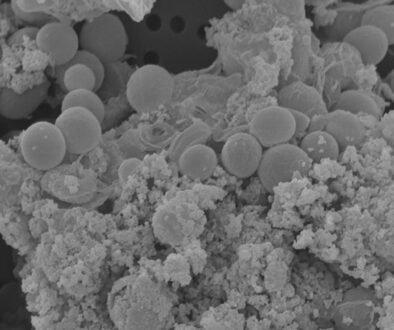 08destaca-Xanthophyceae-y-Eustigmatophyceae-ene-2026