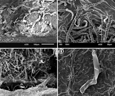 08destaca-trichomes-oct-2025
