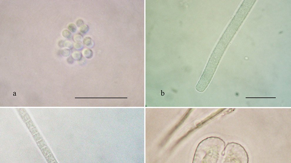 11des-ene-cianoprocariontes-microalgas