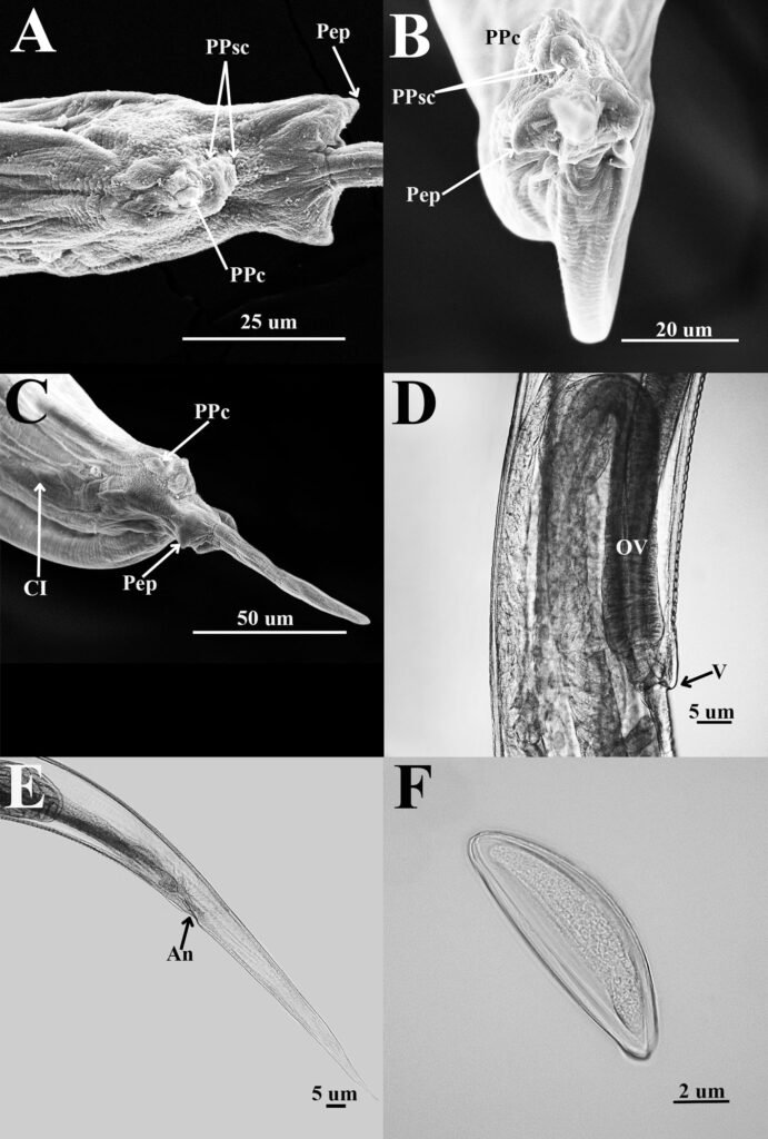 Figure 3. Heteromyoxyuris garciaprietoi n. sp.